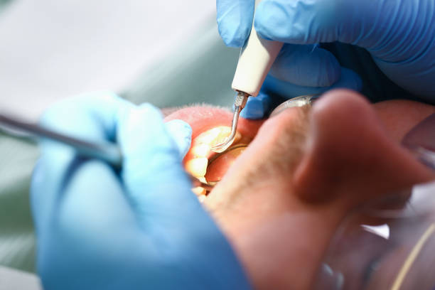 Best Pediatric Emergency Dentist in Watseka, IL